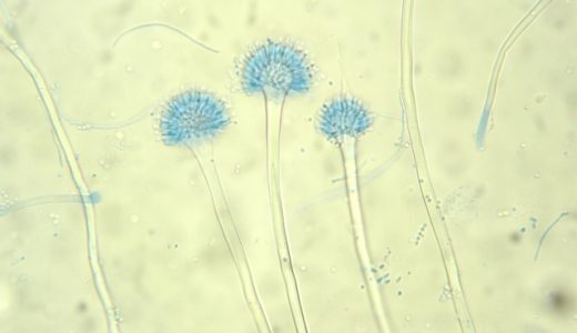 カビの生えた飲み物を飲んでしまった!症状は何時間後?対処法は?